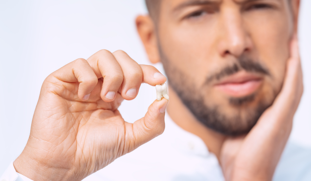 wisdom teeth removal City Dental on Bay Toronto Oct 2025